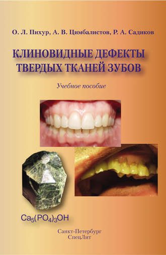 А. В. Цимбалистов. Клиновидные дефекты твердых тканей зубов
