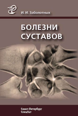 Болезни суставов. 