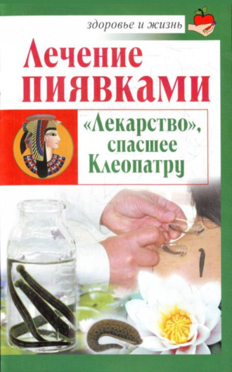 Лечение пиявками. «Лекарство», спасшее Клеопатру. Николай Крамский