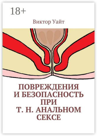 Повреждения и безопасность при т. н. анальном сексе. Виктор Уайт