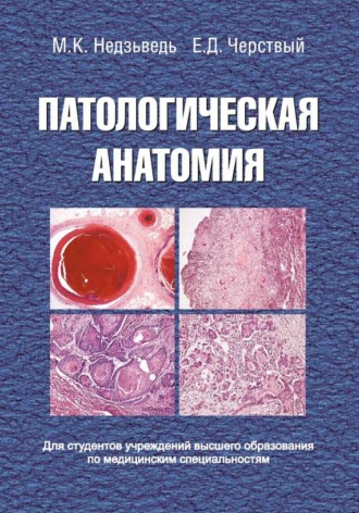 М. К. Недзьведь. Патологическая анатомия