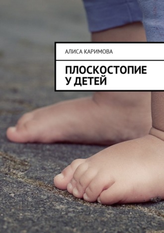 Плоскостопие у детей. 