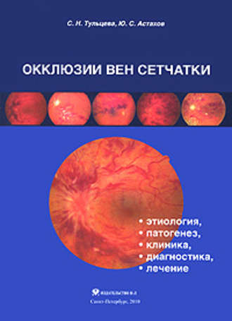 Ю. С. Астахов. Окклюзии вен сетчатки (этиология, патогенез, клиника, диагностика, лечение)