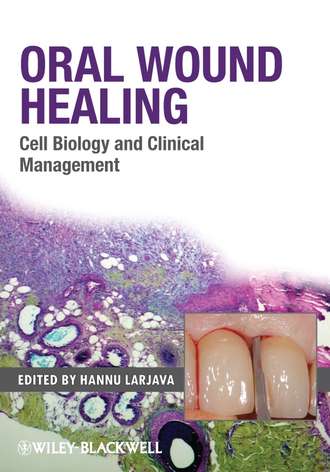 Hannu  Larjava. Oral Wound Healing. Cell Biology and Clinical Management