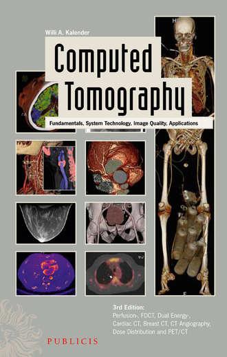 Willi Kalender A.. Computed Tomography. Fundamentals, System Technology, Image Quality, Applications
