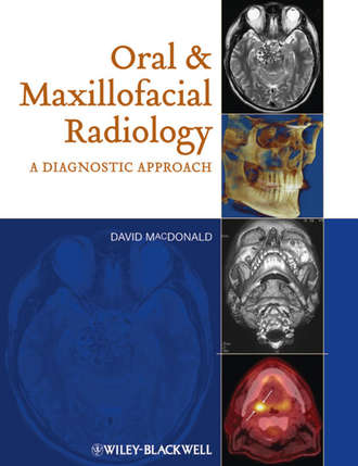 David  Macdonald. Oral and Maxillofacial Radiology. A Diagnostic Approach