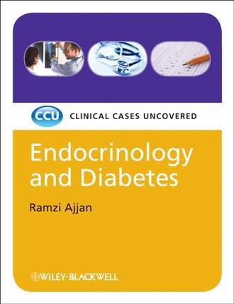 Ramzi  Ajjan. Endocrinology and Diabetes, eTextbook. Clinical Cases Uncovered