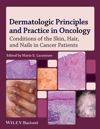 Mario Lacouture E.. Dermatologic Principles and Practice in Oncology. Conditions of the Skin, Hair, and Nails in Cancer Patients