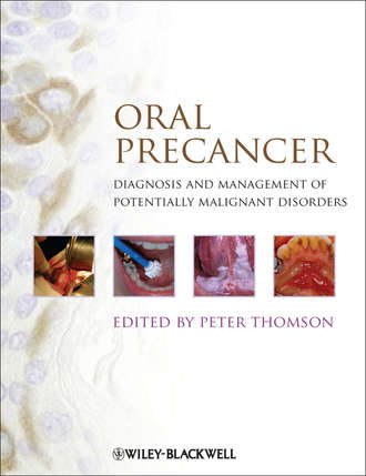 Peter  Thomson. Oral Precancer. Diagnosis and Management of Potentially Malignant Disorders