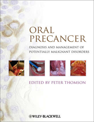 Oral Precancer. Diagnosis and Management of Potentially Malignant Disorders. Peter  Thomson