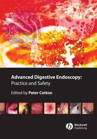 Peter Cotton B.. Advanced Digestive Endoscopy. Practice and Safety