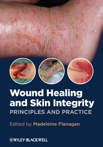 Madeleine  Flanagan. Wound Healing and Skin Integrity. Principles and Practice