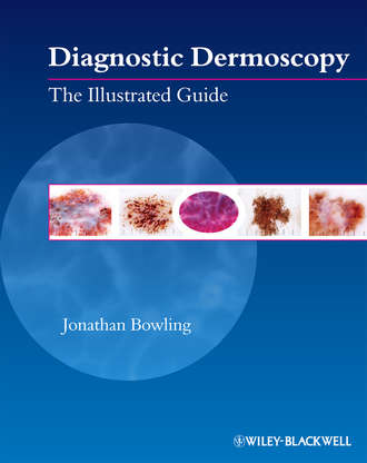 Diagnostic Dermoscopy. The Illustrated Guide. Jonathan  Bowling