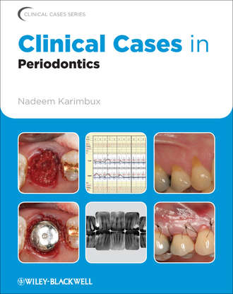 Nadeem  Karimbux. Clinical Cases in Periodontics