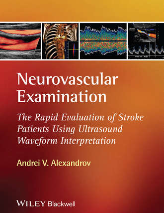 Andrei Alexandrov V.. Neurovascular Examination. The Rapid Evaluation of Stroke Patients Using Ultrasound Waveform Interpretation