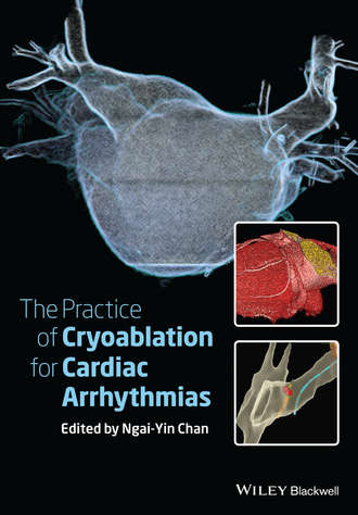 Ngai-Yin  Chan. The Practice of Catheter Cryoablation for Cardiac Arrhythmias