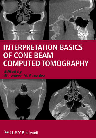 Shawneen Gonzalez M.. Interpretation Basics of Cone Beam Computed Tomography