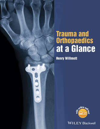 Trauma and Orthopaedics at a Glance. Henry  Willmott