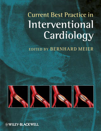 Current Best Practice in Interventional Cardiology. Bernhard  Meier