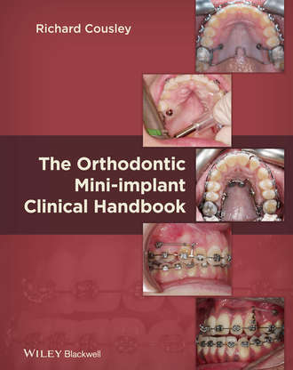 Richard  Cousley. The Orthodontic Mini-implant Clinical Handbook