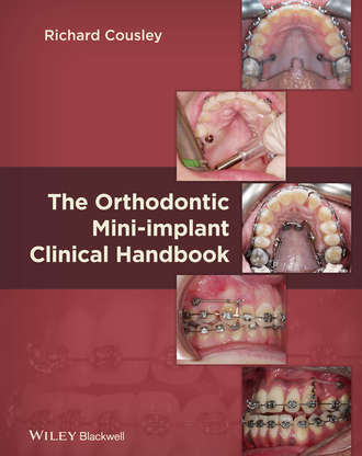 The Orthodontic Mini-implant Clinical Handbook. Richard  Cousley