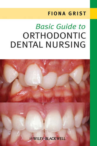 Fiona  Grist. Basic Guide to Orthodontic Dental Nursing