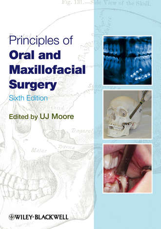 Principles of Oral and Maxillofacial Surgery. U. J. Moore
