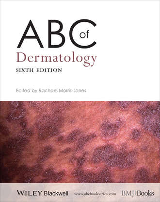 ABC of Dermatology. Rachael  Morris-Jones