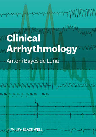 Antoni Bay?s de Luna. Clinical Arrhythmology