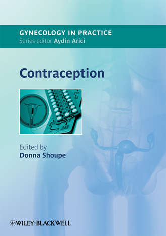 Contraception. Donna  Shoupe