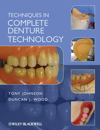 Wood Duncan J.. Techniques in Complete Denture Technology