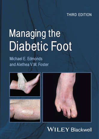 Foster Alethea V.M.. Managing the Diabetic Foot