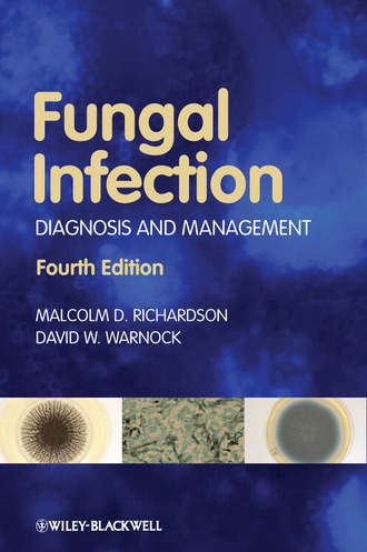 Warnock David W.. Fungal Infection. Diagnosis and Management