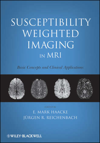 Haacke E. Mark. Susceptibility Weighted Imaging in MRI. Basic Concepts and Clinical Applications