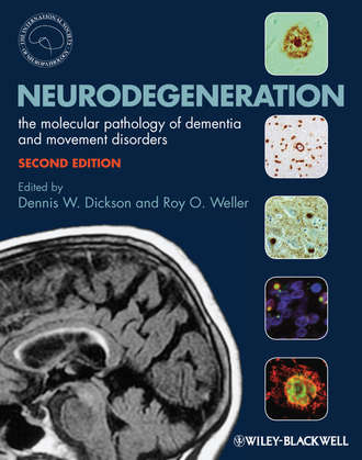 Weller Roy O.. Neurodegeneration. The Molecular Pathology of Dementia and Movement Disorders
