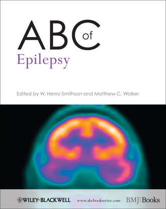 Smithson W. Henry. ABC of Epilepsy