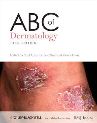 Morris-Jones Rachael. ABC of Dermatology