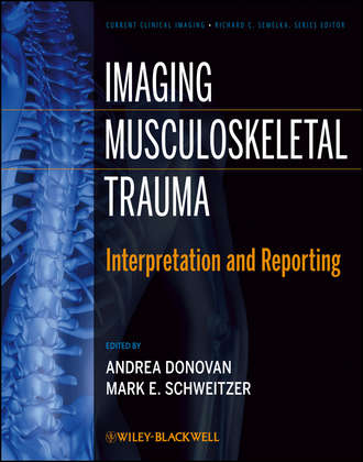 Schweitzer Mark E.. Imaging Musculoskeletal Trauma. Interpretation and Reporting