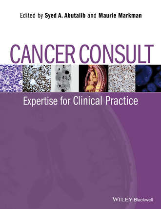 Markman Maurie. Cancer Consult. Expertise for Clinical Practice