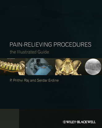 Erdine Serdar. Pain-Relieving Procedures. The Illustrated Guide
