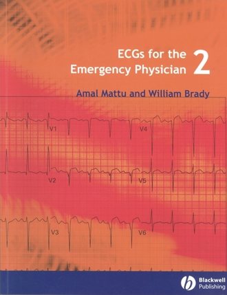Brady William J.. ECGs for the Emergency Physician 2
