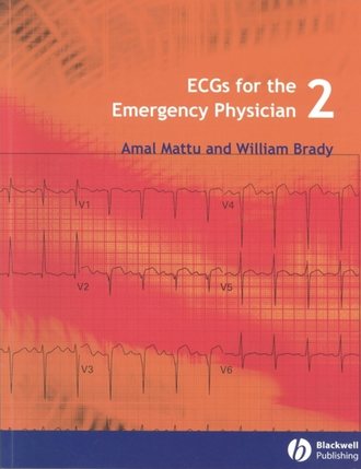 ECGs for the Emergency Physician 2. 