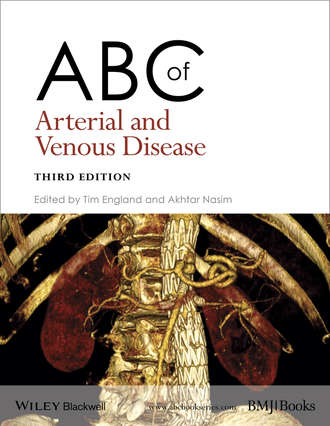 Nasim Akhtar. ABC of Arterial and Venous Disease