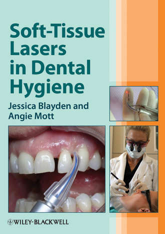Mott Angie. Soft-Tissue Lasers in Dental Hygiene
