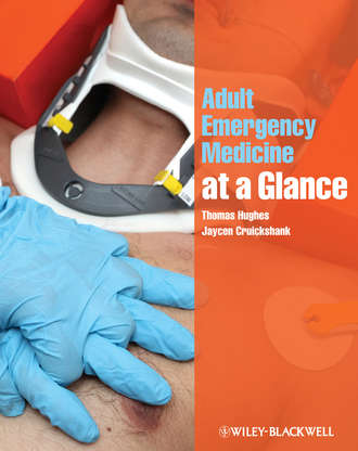 Hughes Thomas. Adult Emergency Medicine at a Glance