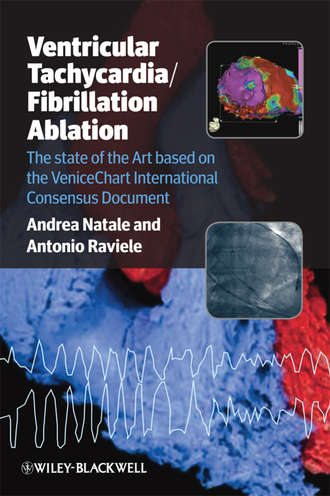 Raviele Antonio. Ventricular Tachycardia / Fibrillation Ablation. The state of the Art based on the VeniceChart International Consensus Document