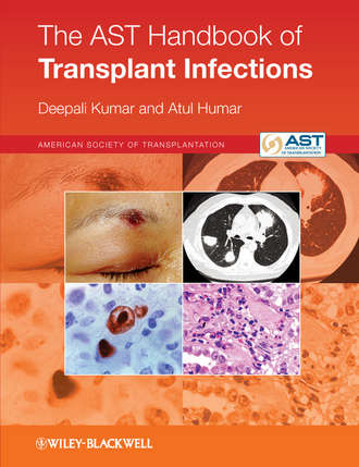 Humar Atul. The AST Handbook of Transplant Infections
