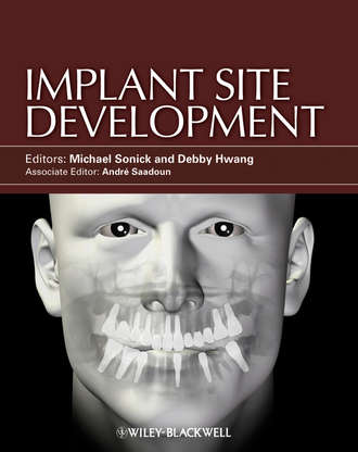 Sonick Michael. Implant Site Development