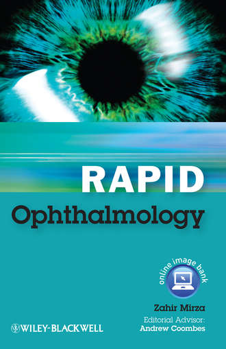 Coombes Andrew. Rapid Ophthalmology