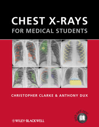 Clarke Christopher. Chest X-rays for Medical Students